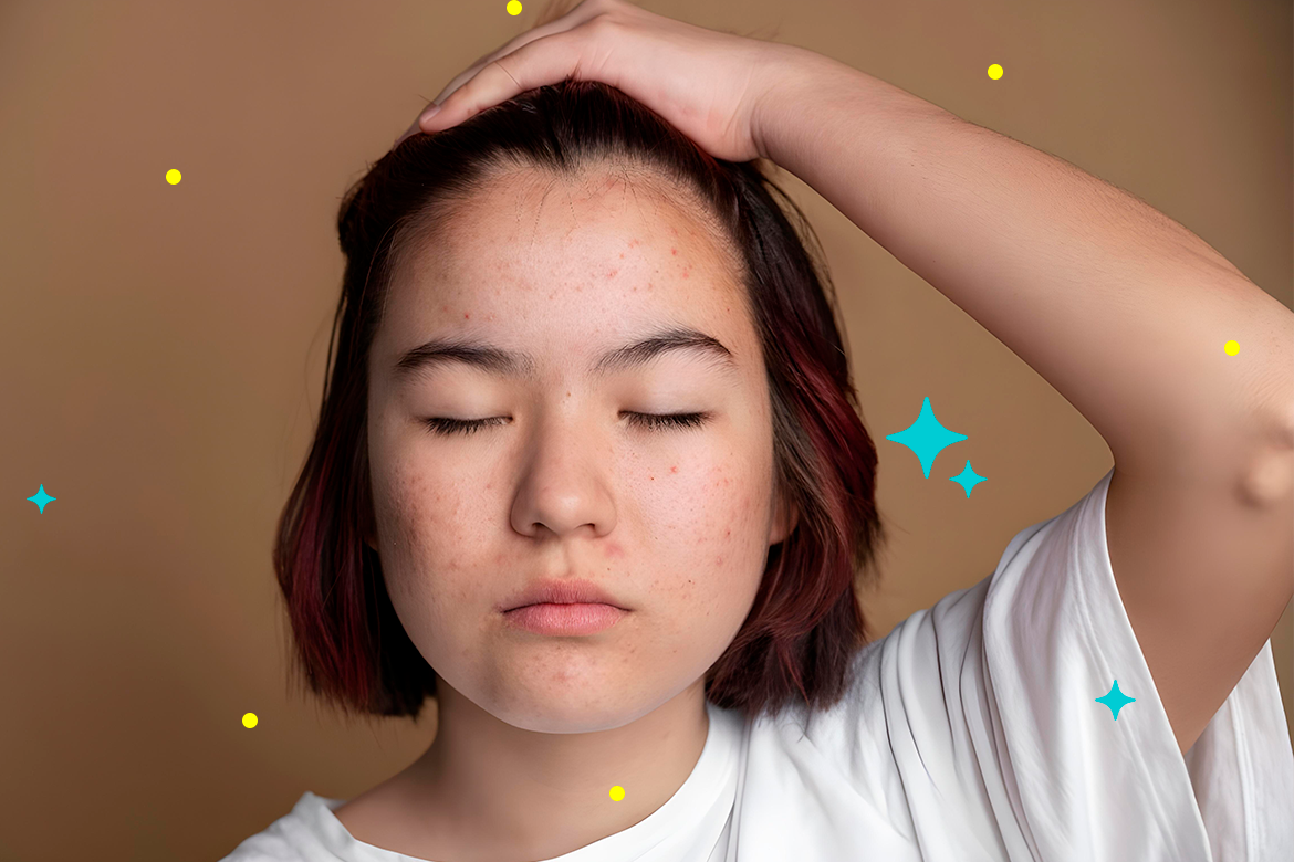 Dermatosis Neglecta: cuando la piel pide atención.